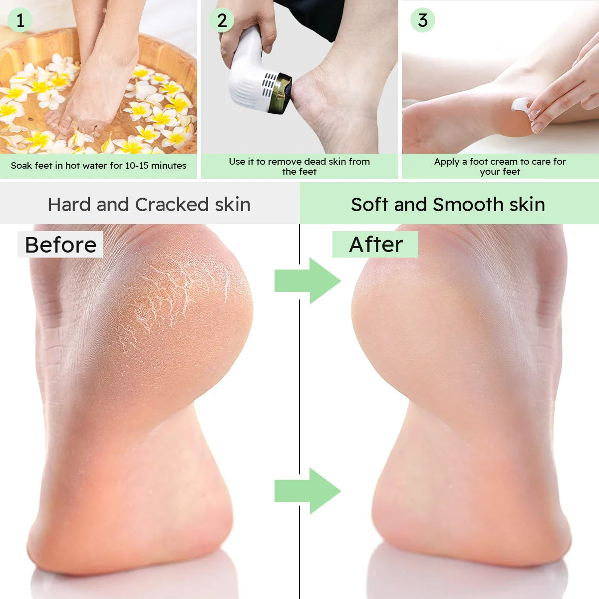 Rechargeable Foot Callus Remover